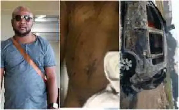 Xenophobia: Nigerian man killed in South Africa, others injured in fresh attack (Photo)